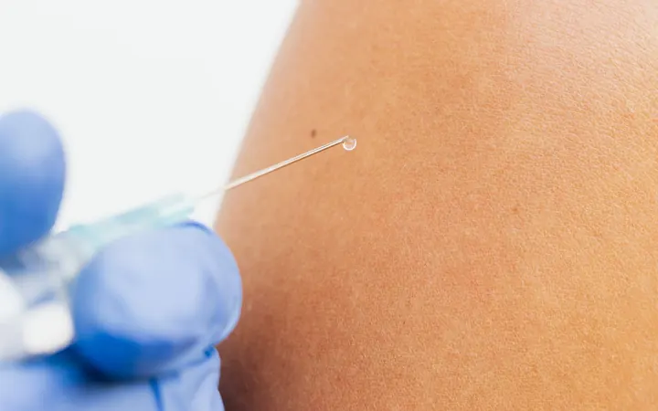 Aplicação intradérmica com agulha fina