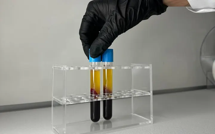 Tubos com plasma separado em suporte de laboratório