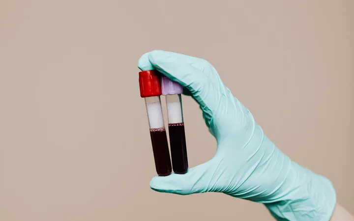 Mão com luva segurando tubos de sangue com plasma separado