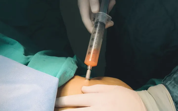 Aplicação intra-articular no joelho